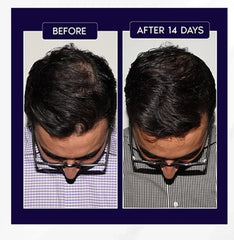 FEG PLUS Hair Growth Spray 50ml